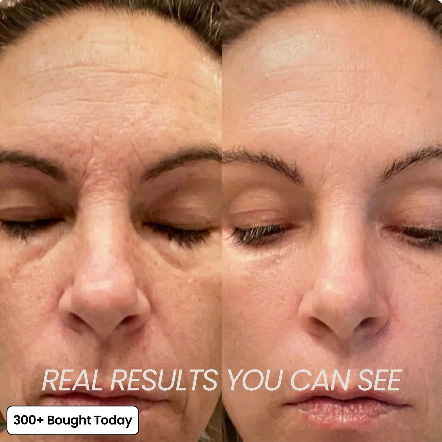 (🔥LAST DAY B2G1 FREE)Oralyhzf Korean PDRN Pink Collagen Volume Multi Balm