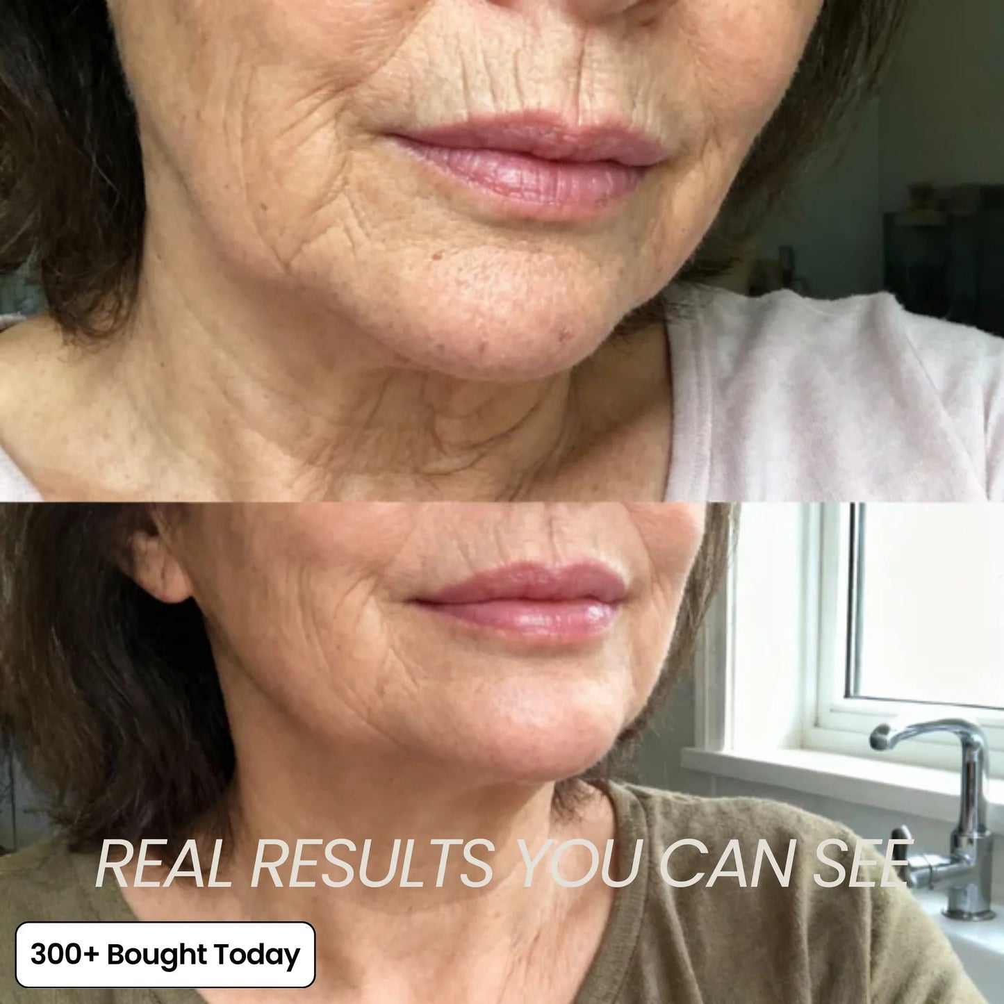 (🔥LAST DAY B2G1 FREE)Oralyhzf Korean PDRN Pink Collagen Volume Multi Balm