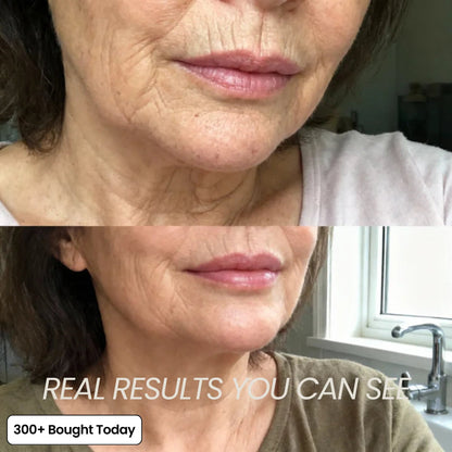 (🔥LAST DAY B2G1 FREE)Oralyhzf Korean PDRN Pink Collagen Volume Multi Balm